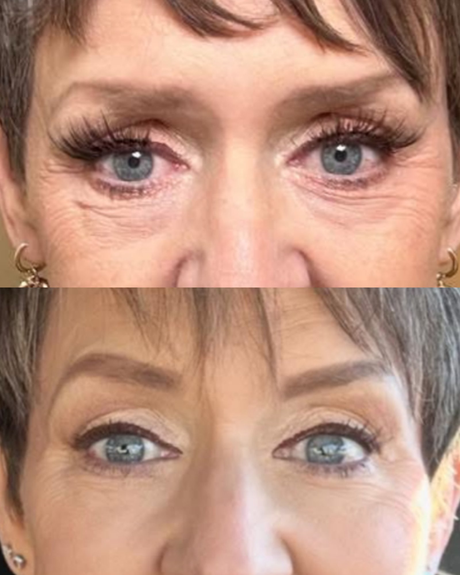 Midface Balance at Danna Lux Medspa