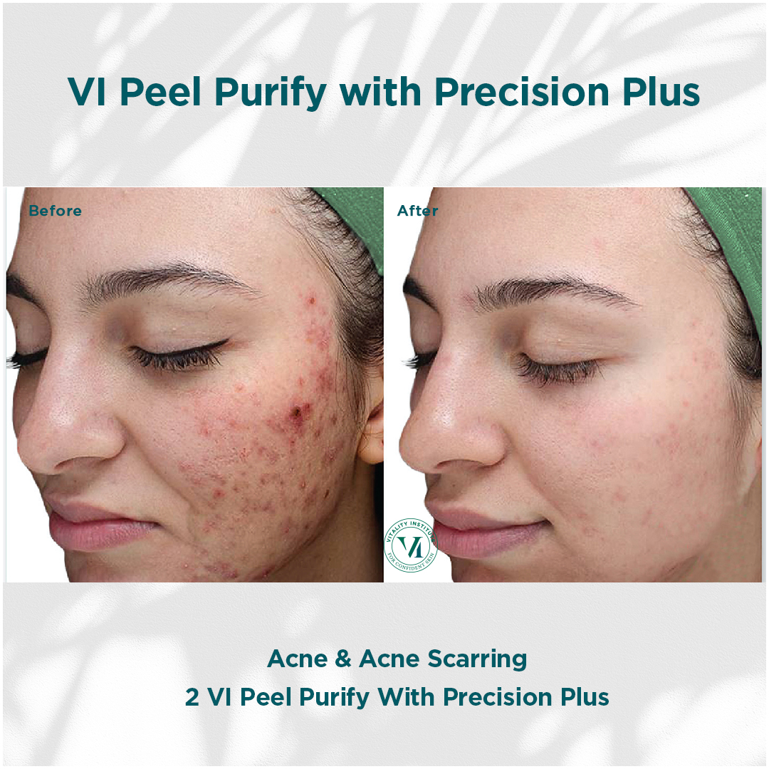 ToxBooster Treatment result 1