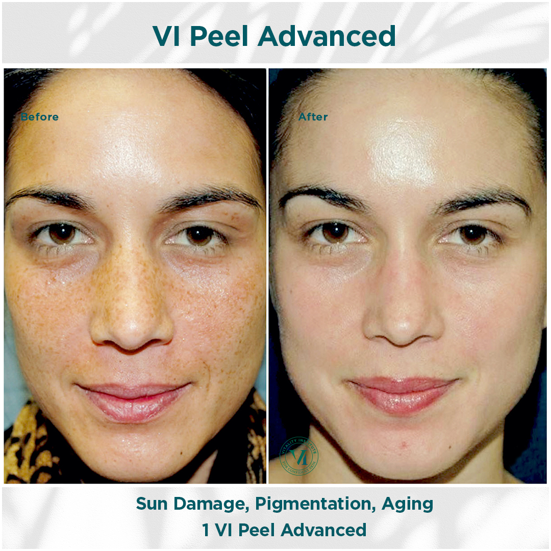 ToxBooster Treatment result 3